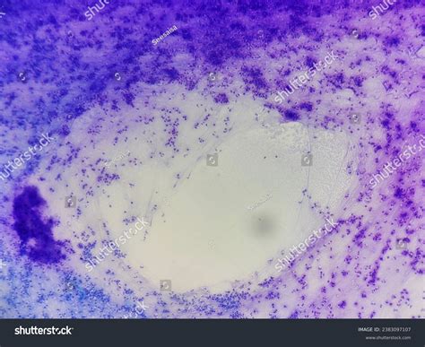 Image result for Diff Quick Stain