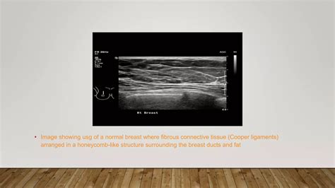 Birads classification of breast.pptx