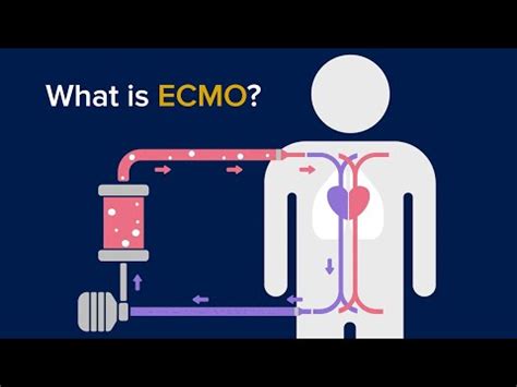 Elite Lifecare - Manufacturer of cardiac heart surgery perfusion device ...