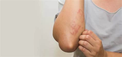 10 Common Skin Problems In Children | Aster CMI Blogs