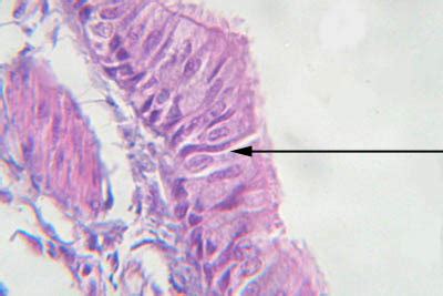 Image result for Ephilehal Tissue Sample