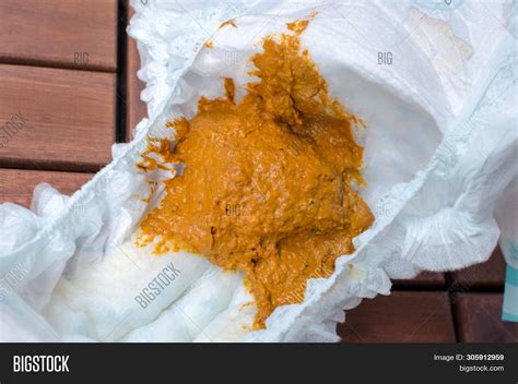 Why Does My Child Have Yellow Diarrhea at Charles Macias blog