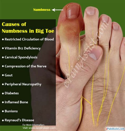 Causes of Numbness in Big Toe & its Treatment
