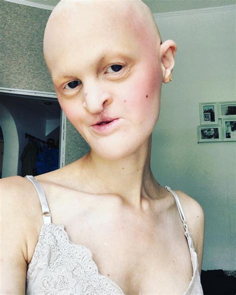 Image result for Alien Self Disorder Akbar