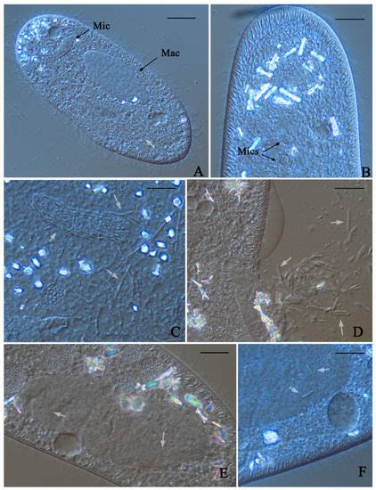 Paramecium Diversity and a New Member of the Paramecium aurelia Species ...