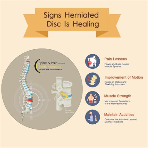 Signs Herniated Disc Is Healing – SAPNA Pain Management Blog