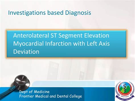 Myocardial Infarction - Case Presentation and an Overview | PPTX