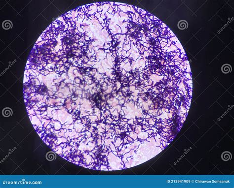 Bacillus Gram Positive Stain Under Microscope View. Bacillus Is Rod ...