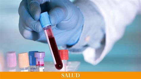 ¿Cuáles son los valores normales de creatinina en niños?