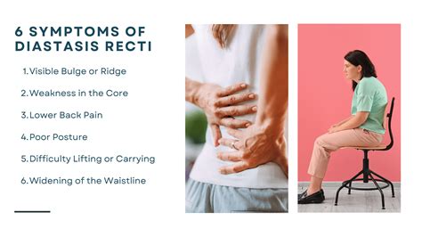 Chiropractic Care for Treating Diastasis Recti