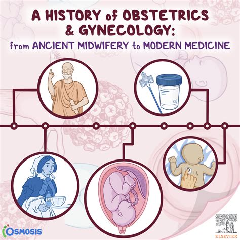 A History of Obstetrics and Gynecology: From Ancient Midwifery to Modern Medicine - Osmosis Blog