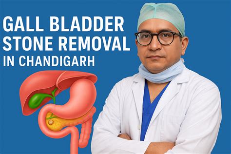 Gall Bladder Stone Removal in Chandigarh