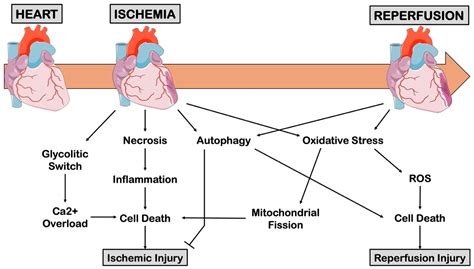 An Overview of the Molecular Mechanisms Associated with Myocardial ...