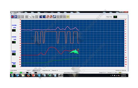 High Resolution Manometry India,MMS,pH RecorderORION II,Ambulatory ...