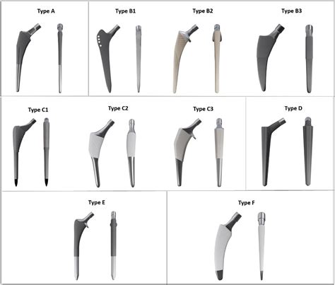 Cementless Femoral Stems in Primary Total Hip Arthroplasty | Published in Journal of Orthopaedic ...