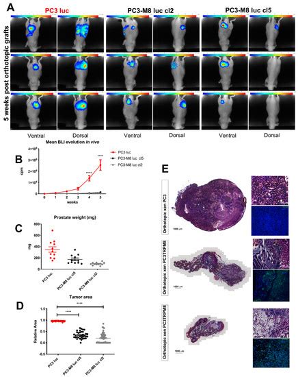 TRPM8 as an Anti–Tumoral Target in Prostate Cancer Growth and ...