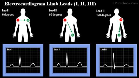 Electrocardiogram