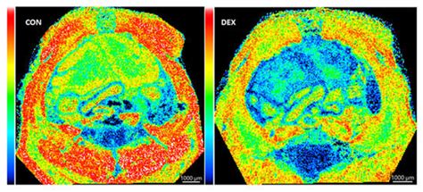 Mass Spectrometry Imaging (MSI) Delineates Thymus-Centric Metabolism In ...