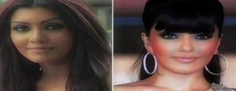 Before and After Photos of Bollywood Celebs Who Have Gone Under the ...