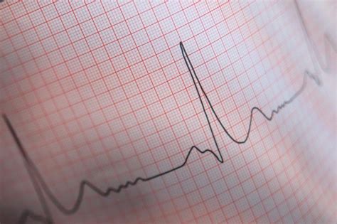 Quaternions in Python 的图像结果