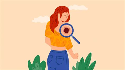 Gordon Ramsay Skin Cancer: Lessons on Prevention and Early Detection