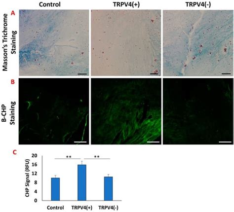 Modulating TRPV4 Channel Activity in Pro-Inflammatory Macrophages ...