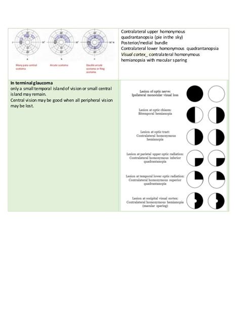 Image result for Contralateral Visual Field
