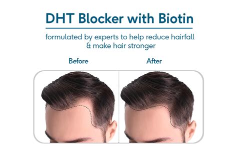 HealthKart HK Vitals DHT Blocker with Biotin, Stinging Nettle and Soya ...