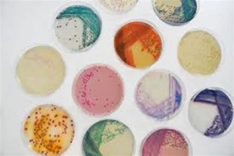 Microbiological Culture Media - Defibrinated Sheep Blood Trader ...