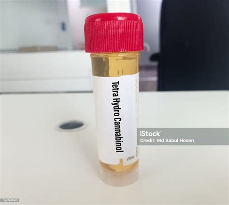 Drug Test General Toxicology Urine Quest at Nathan Lozano blog