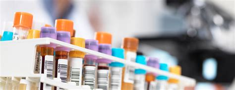 Quadruple screen test