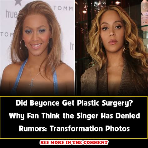 Did Beyonce Get Plastic Surgery? Why Fan Think the Singer Has Denied ...