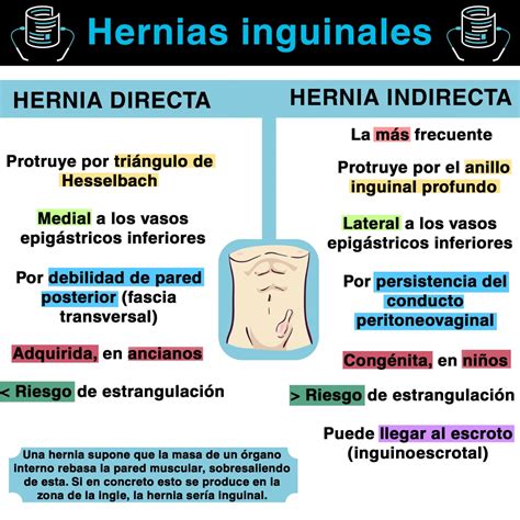 Tipos De Hérnias Inguinais - FDPLEARN