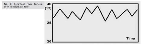 Fever Patterns 的图像结果