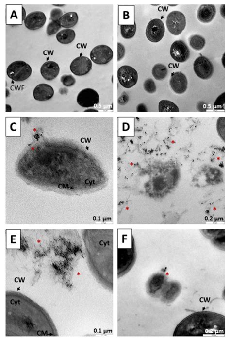 Use of Nanoparticles to Prevent Resistance to Antibiotics—Synthesis and ...
