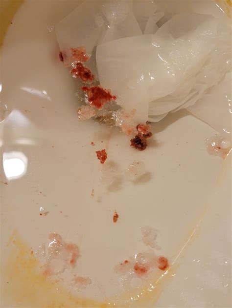 Blood Vomit Pregnancy