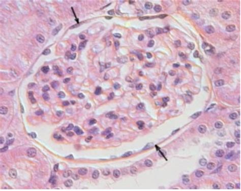 Image result for Ephilehal Tissue Sample