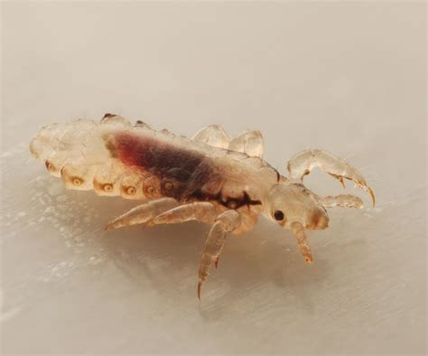 Does vinegar kill lice? Pest control professionals explain | Homes and ...