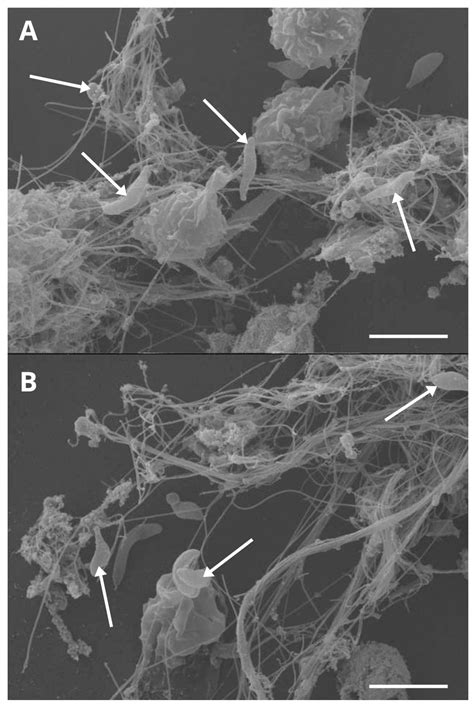 Besnoitia besnoiti-Induced Neutrophil Extracellular Traps (NETs ...