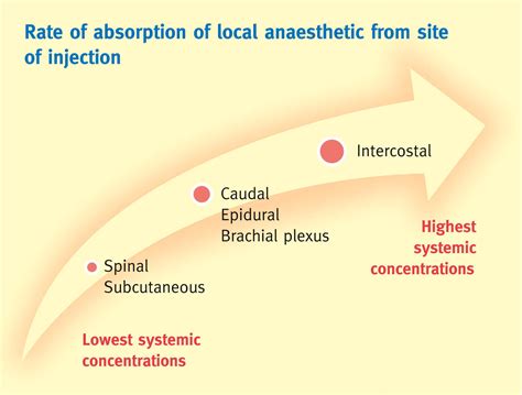 Local Anesthetic Systemic Toxicity Risk Factors at David Pisani blog