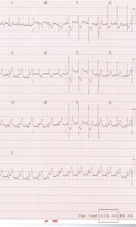 ECG - App on Amazon Appstore