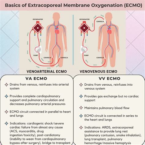 Image result for ECMO Procedure