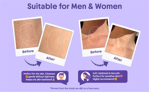 Buy Aravi Organic 10% AHA + 1% BHA Body Lotion For Exfoliation - Treats ...