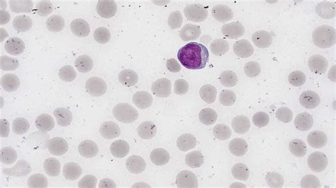 Image result for Lymphocytes Microscopic View