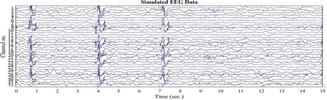 Image result for EEG MATLAB Load File