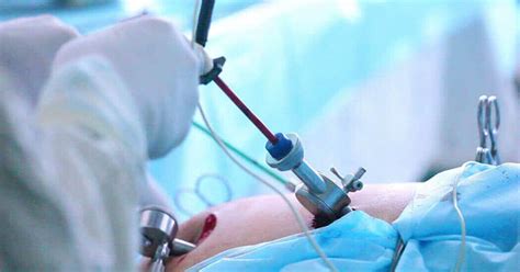 Diagnostic Laparoscopy Procedure | Dr. Sarada