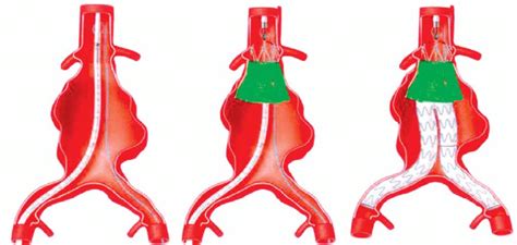 Procedure 的图像结果