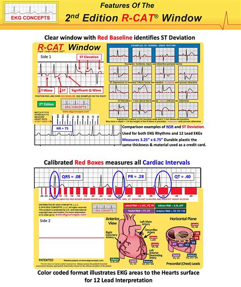ECG Card (EKG) R-CAT Window. ECG tool for paramedics, nurses and ...