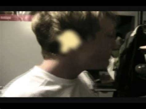 Image result for Worst Exploding Pimple