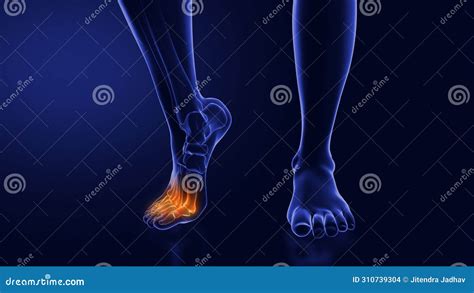 Ball of Foot Pain Running 的图像结果